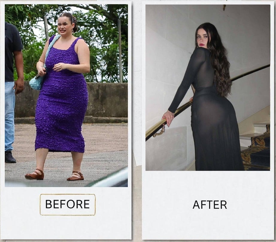 Ozempic Barbie: Actress Barbie Ferreira Is No Longer Plus-Size